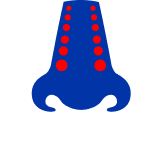 Mezi hlavní příznaky zánětu vedlejších nosních dutin patří ucpaný nos. 